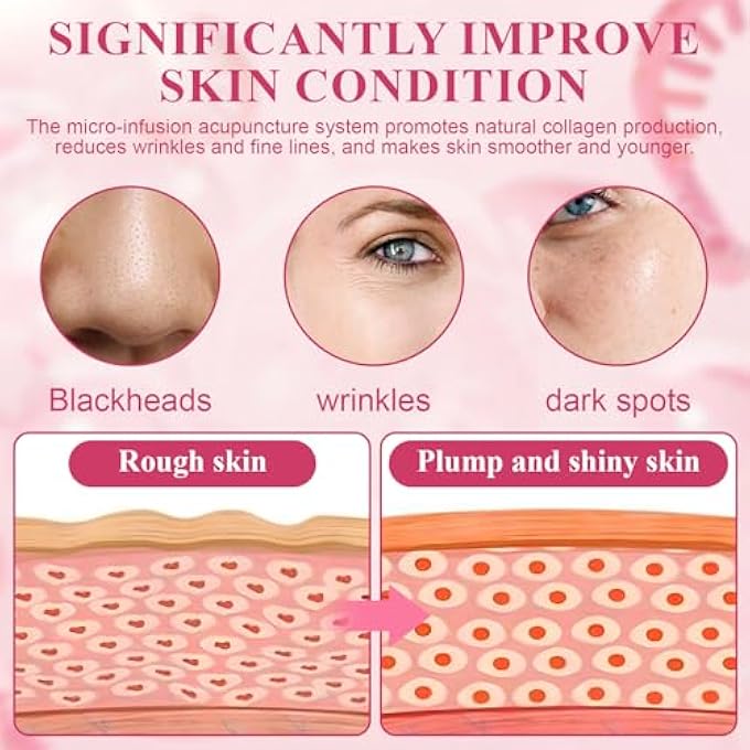 STRBOXONG نظام الحقن الدقيق، مجموعة الإبر الدقيقة للوجه، حقن دقيق للوجه مع 6 أمبولات إبر دقيقة و 2 رولر مضمونة، حقن دقيق لمكافحة الشيخوخة، سيروم للوجه لتنعيم التجاعيد - Image 4